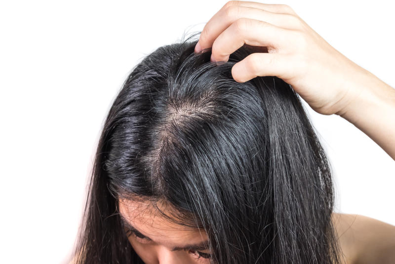 خلطات طبيعية من زيت الخروع لمليء فراغات الشعر وزيادة كثافته
