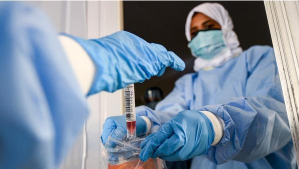 الصحة العالمية:انخفاض نسبة وفيات فيروس كورونا 39%