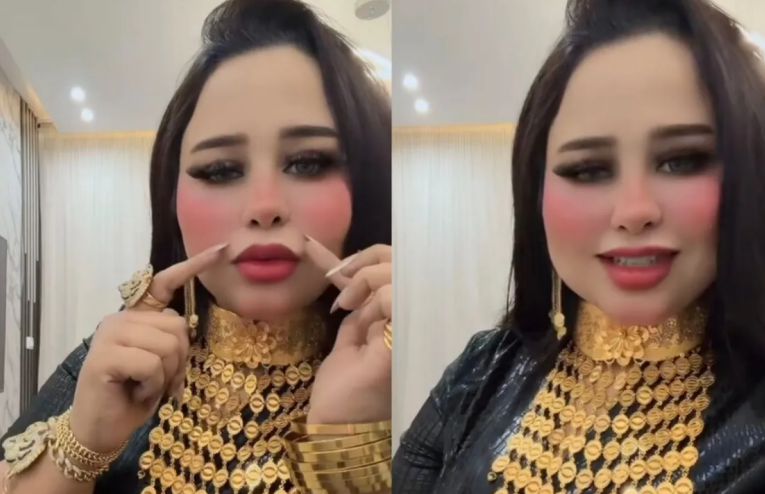 مصر .. القبض على طبيبة وهمية تدير إمبراطورية تجميل