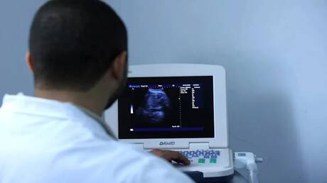 تحذير صادم في مصر ..  عادة تجميلية شائعة قد ترتبط بالسرطان