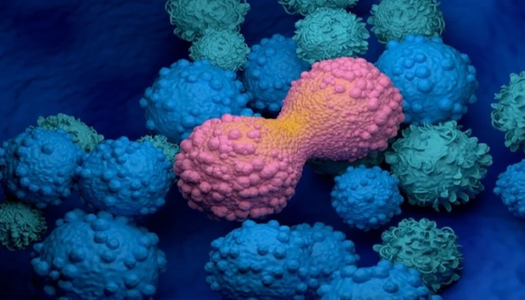 "بصيص ضوء" يهزم الخبيث ..  جهاز استشعار جديد يكتشف السرطان قبل فوات الأوان