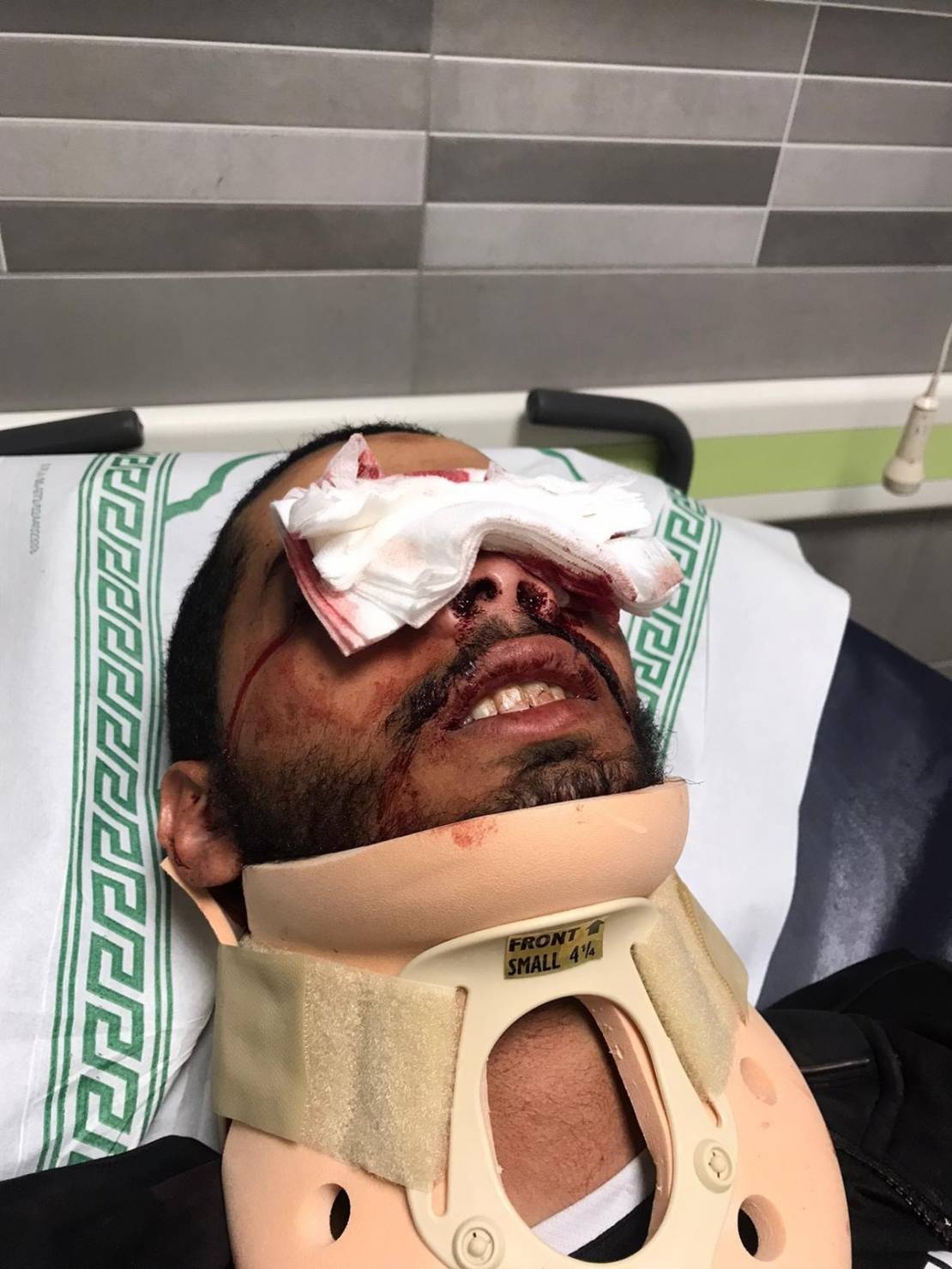 لماذا يتعمد الاحتلال إطلاق النار على العيون؟