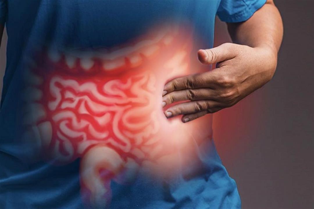 أسباب الإصابة بمرض (كرون) فى الأمعاء الدقيقة والقولون
