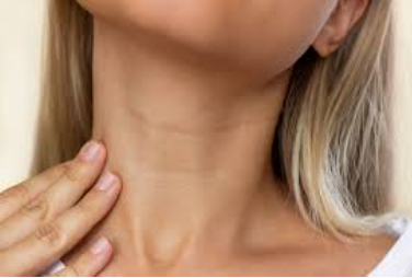 طرق علاج وتجديد جلد الرقبة وتأخير ظهور التجاعيد