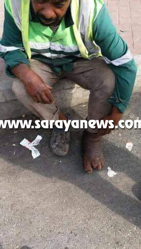 اربد: المرض ينهش قدم عامل وطن  .. وبني هاني يوضح لسرايا .. تفاصيل