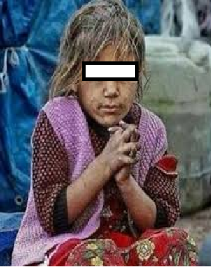 مناشدة لاهل الخير : طفلتين من ذوات الاحتياجات الخاصة بحاجة لعلاج فوري 
