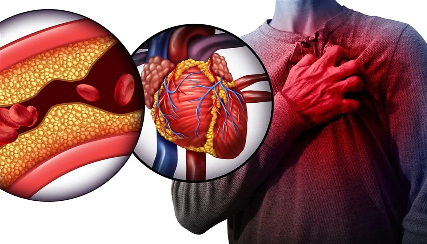 أعراض للنوبة القلبية تظهر قبل أسابيع من حدوثها