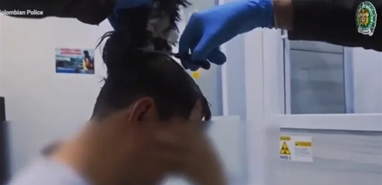 بالفيديو ..  مشهد صادم لرجل حاول تهريب المخدرات داخل رأسه