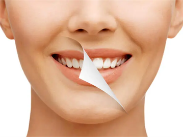 تنظيف الأسنان عند الطبيب بانتظام .. الإيجابيات والسلبيات
