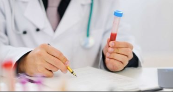 منتصف رمضان ..  5 تحاليل طبية يُنصح بإجراؤها لمراقبة الصحة