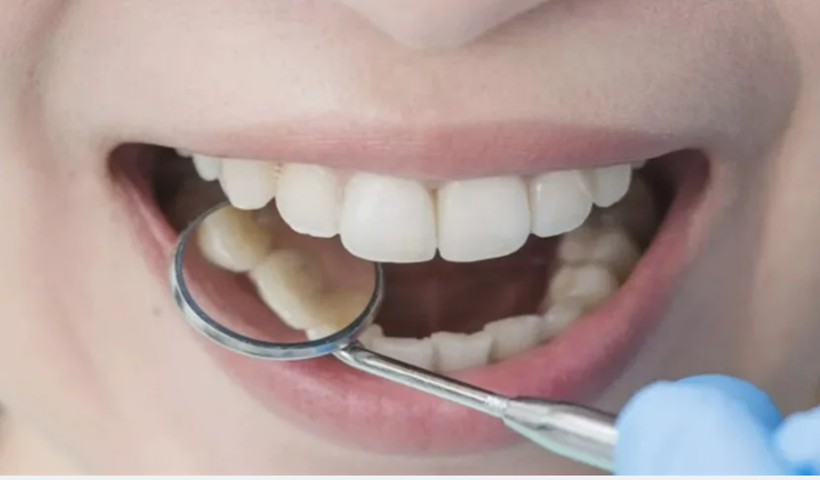 دراسة يابانية صادمة ..  عدد أسنانك قد يتنبأ بموعد رحيلك