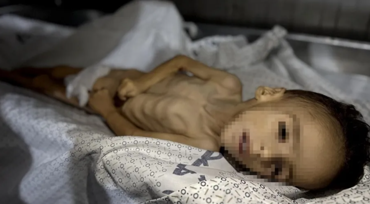 غزة ..  "إسرائيل" جوعت الطفل محمد زكريا وتوفي بوزن 3 كيلو غرامات
