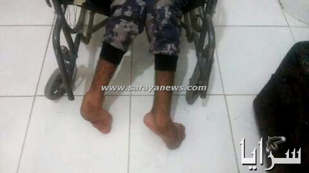 بالصور   ..  معاق حركيا يستعطف اهل الخير  لدفع تكاليف علاجه 