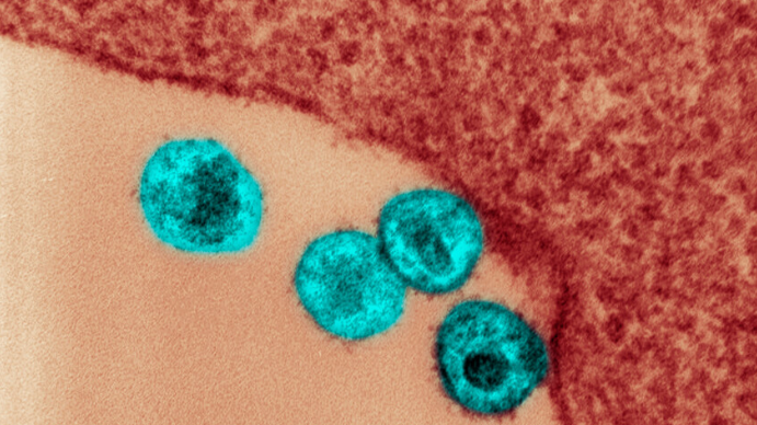 يحملها شقيقه ..  طفرة جينية نادرة تنهي معاناة "مريض أوسلو" مع الإيدز والسرطان معا!