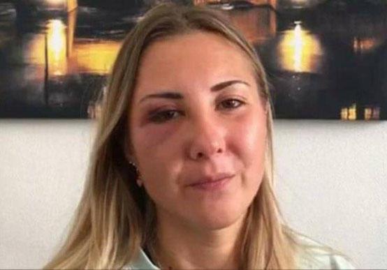 اعتداء على فرنسية بسبب تنورتها القصيرة  