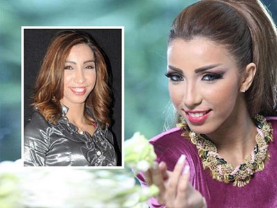 بالصور ..  دنيا بطمة قبل وبعد عمليات التجميل