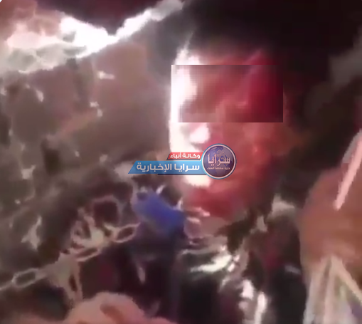 فيديو تقشعر له الأبدان  ..  "بابا اقتلني" صرخة تفطر القلوب ..  الطفل المعنف "محمد" يطلب الموت لإنهاء معاناته