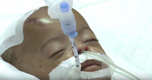 الإمارات: طفلة تدخل في غيبوبة بعد اعتداء خادمة عليها