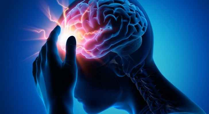 دراسة: السكتة الدماغية تزيد خطر الإصابة بالخرف