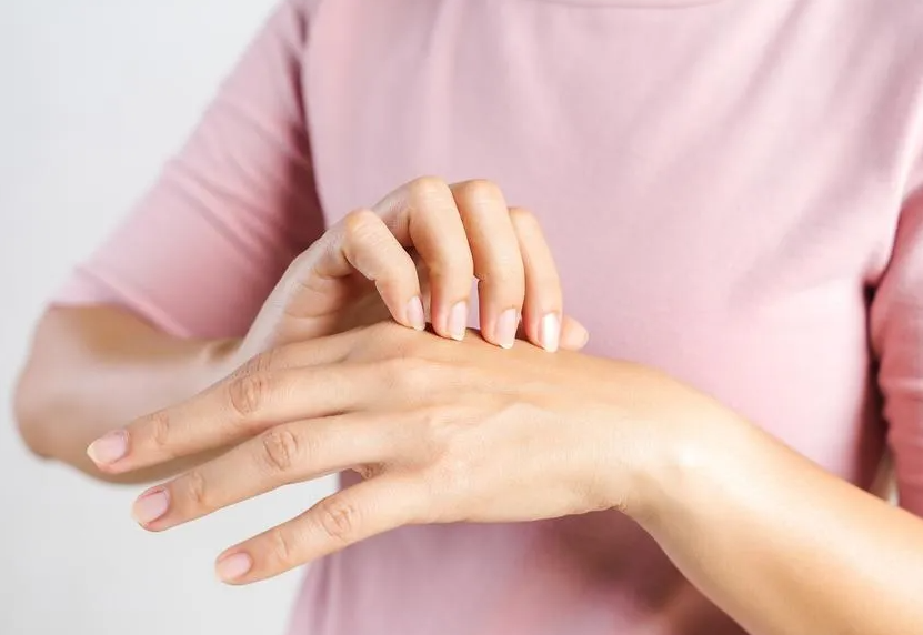 أفضل النصائح للتخلص من إكزيما الشتاء ..  طبقيها على الفور