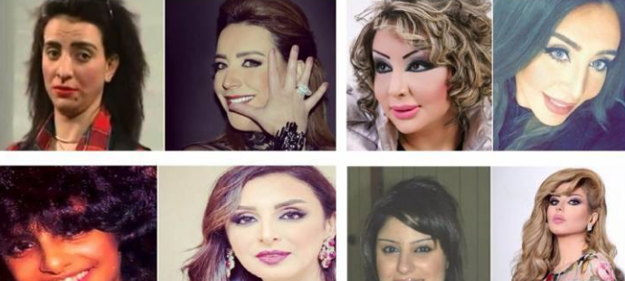بالصور .. نجمات انقلب جمالهن قبل وبعد التجميل!