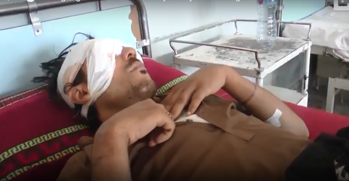 بالفيديو : رجل يقتلع عيني نجله بـ”ملعقة” لسبب غير متوقع 