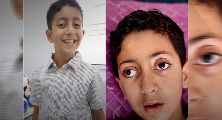 محمد معمر ..  طفل غزي يعالج في الأردن يستعيد بصره وقدرته على المشي