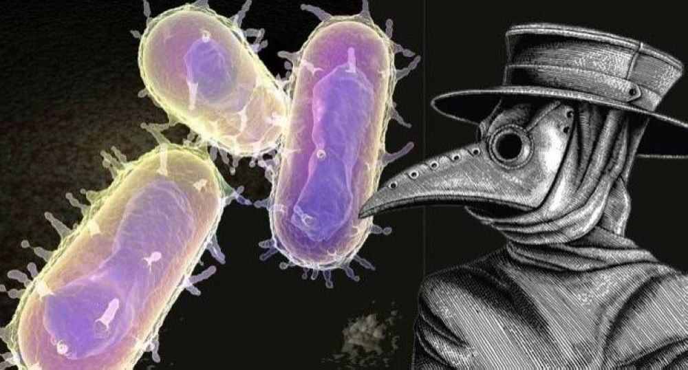  يُسمى "الموت الأسود" ..  تعرّف على الطاعون الدبلي
