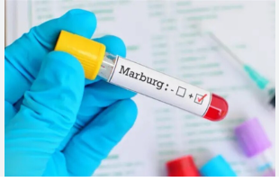 بعد انتشار الشائعات ..  وزارة الصحة المصرية تؤكد: فيروس ماربورغ لا يهدد مصر