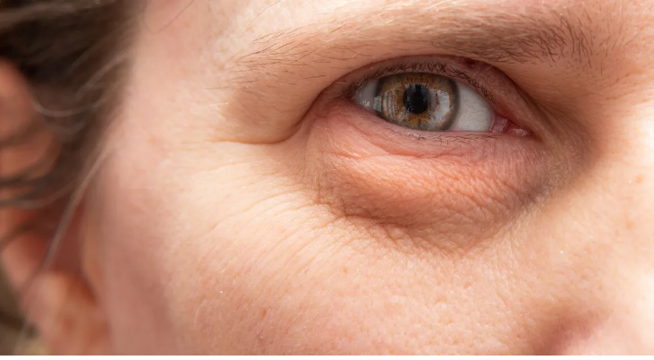 أسباب عدة لجفاف العين  ..  نصائح طبية تهمكم لصحة العين ونظافتها