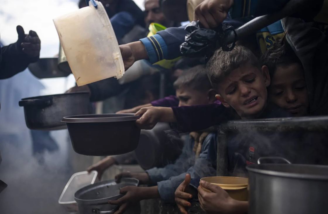 “الأونروا”: واحد من بين كل 3 أطفال مصاب بسوء التغذية في غزة