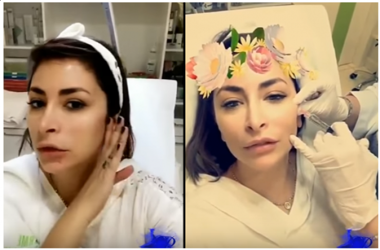 بالفيديو ..  ديما بياعة تنشر فيديو من غرفة عمليات التجميل