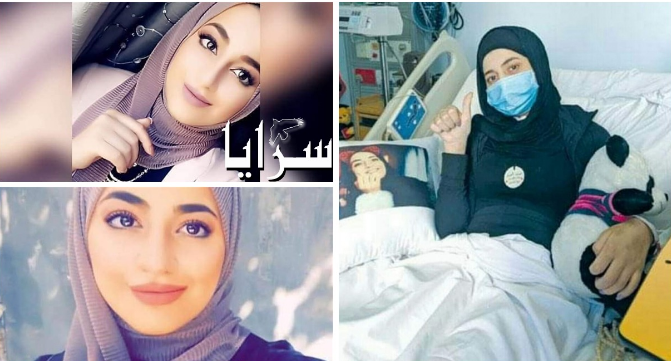 بلقيس بني هاني تقاوم السرطان بصبر وعزيمة بعد تشوهها وفقدان سمعها وبصرها .. والدها لـ"سرايا":لو يعود الزمن لم أجرِ لها العملية 