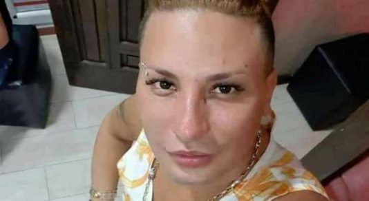 تفاصيل صادمة  ..  عملية تجميل تنهي حياة مغني جزائري شهير 