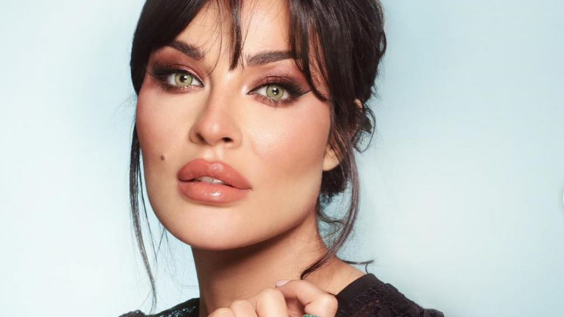 شاهدوا  ..  "نادين نجيم" في احدث جلسة تصوير بعد اصابتها بانفجار بيروت
