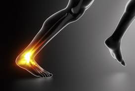 ما وتر العرقوب وأسباب التهابه؟ 6 طرق للعلاج