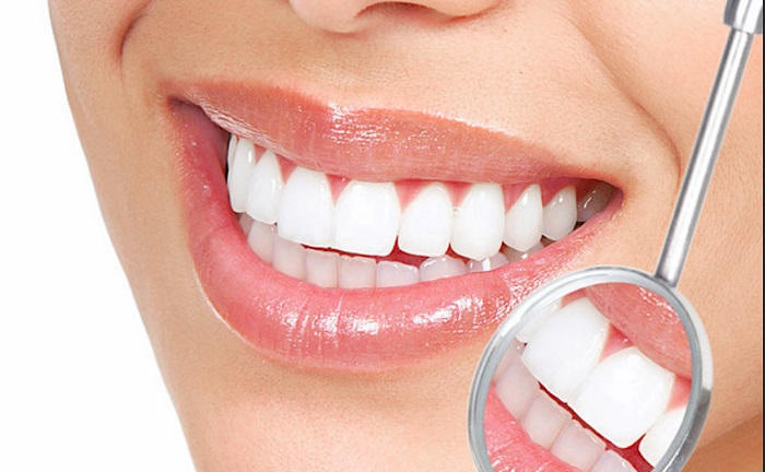 هناك العديد من الطرق المتاحة لتبييض أسنانك