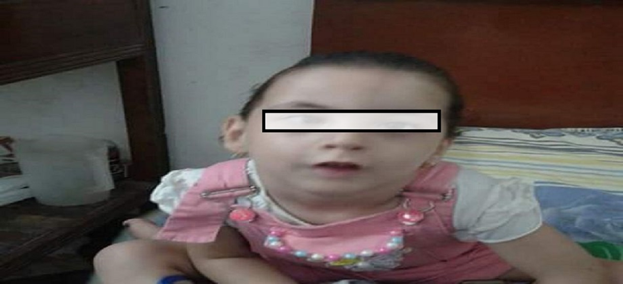طفلة عمرها (4) سنوات تعاني من ضمور بالعين تناشد اهل الخير لتوفير عين اصطناعية لها 
