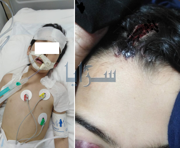 وفاة الطفل "يحيى" متأثرًا بعضة كلب ضال في عمّان ووالده يوجه رسالة لجمعيات حقوق الحيوان: "بتقدروا ترجعولي ابني ؟"