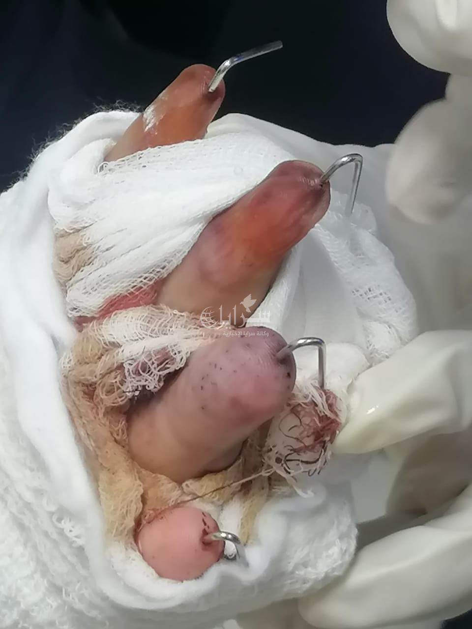صور صادمة  ..  شاب يقطع أصابع آخر خلال مشاجرة داخل صالون حلاقة في الرصيفة والامن يلقي القبض على عدد من المتورطين 