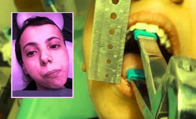 بالفيديو  ..  المرض الذي منع فاطمة اليمنية من فتح فمها طوال 30 سنة فاستحال تحريكه " تفاصيل "