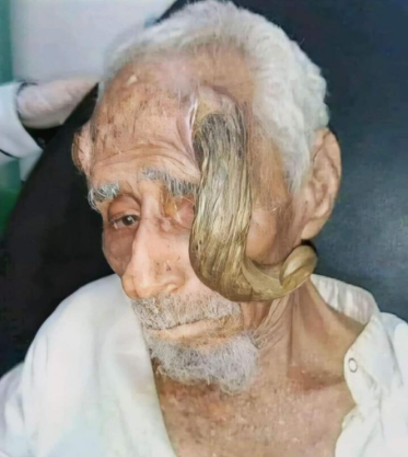وفاة المعمر اليمني "ذي القرنين" عن عمر ناهز 140 عاما - صور