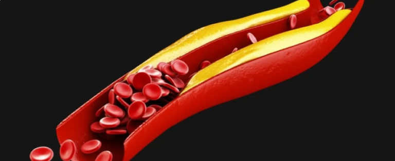 نظام غذائي بسيط قد يخفض الكوليسترول الضار