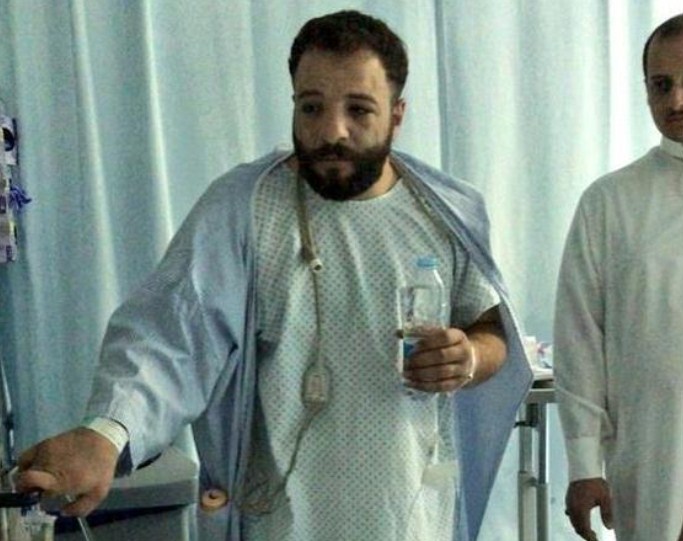 اردني ينقذ حياة صديقه السعودي من الموت و يتبرع له بكليته