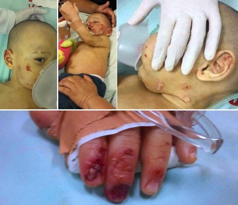 بالفيديو  ..  جريمة بشعة : قصة لبناني عضعض طفل و قلع أظافره وحرّق جسمه بسيجارة