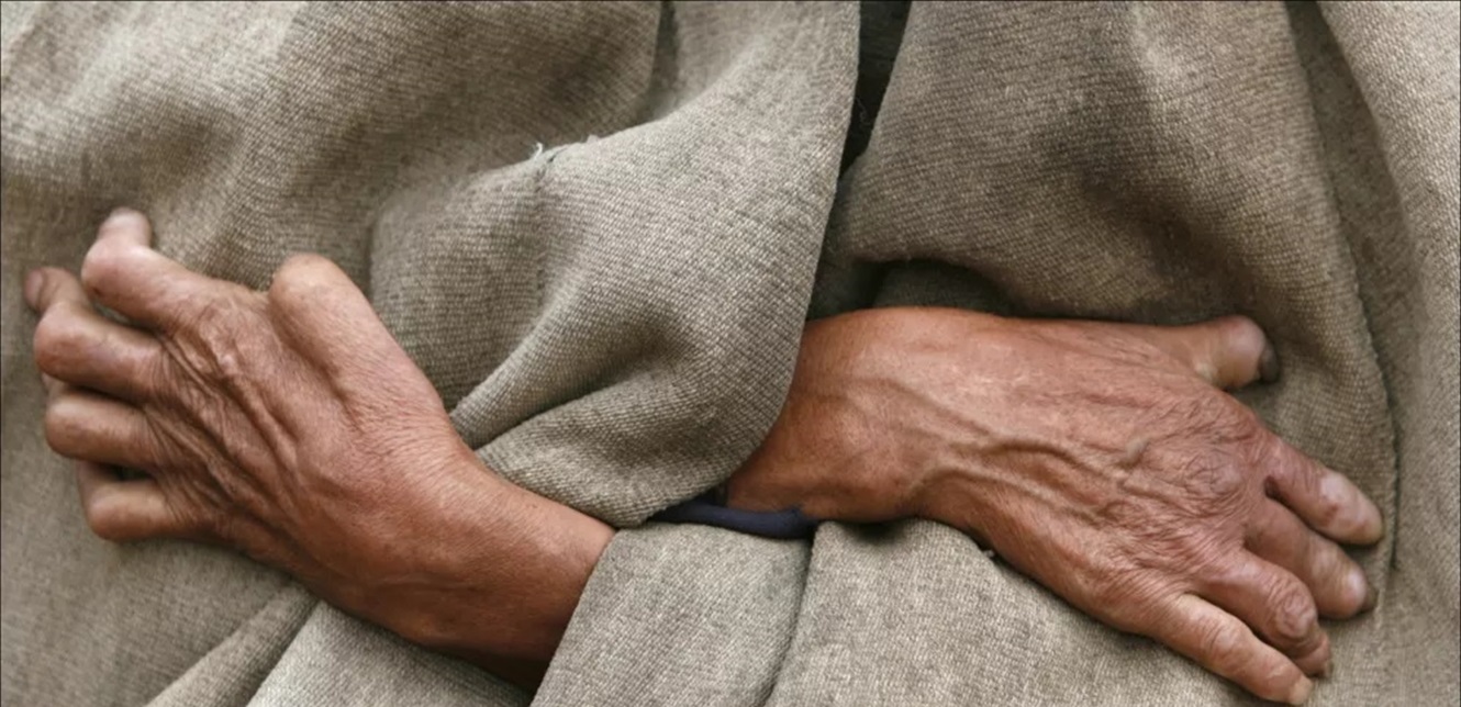 مصر تضع هدفها القضاء على مرض خطير