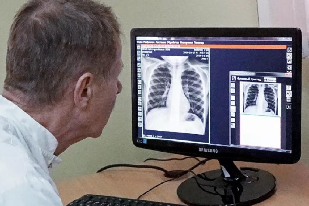 5 أطعمة تقلل خطر الإصابة بسرطان واضطرابات الرئة