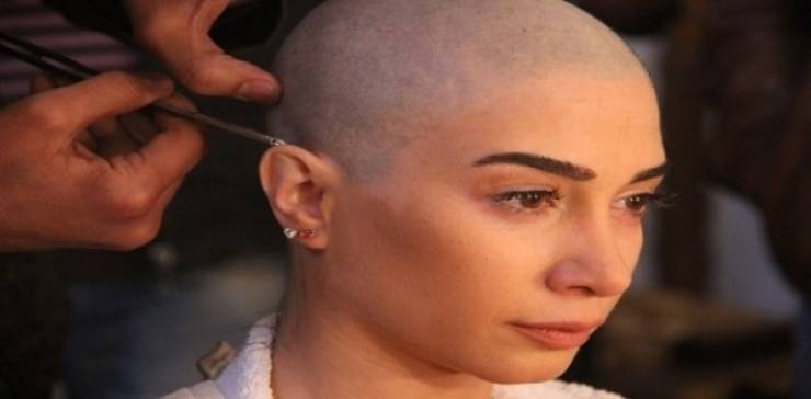 صورة ..  هل تذكرون الفنانة السورية التي حلقت كامل شعرها؟ هكذا أصبحت الان