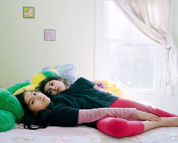 توأمتان ملتصقتان ترفضان الانفصال منذ 16 عاما "صور"