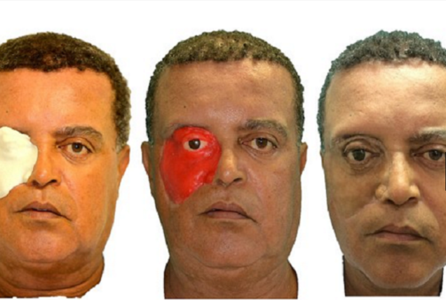 أول شخص في العالم يحصل على وجه بتقنية 3D